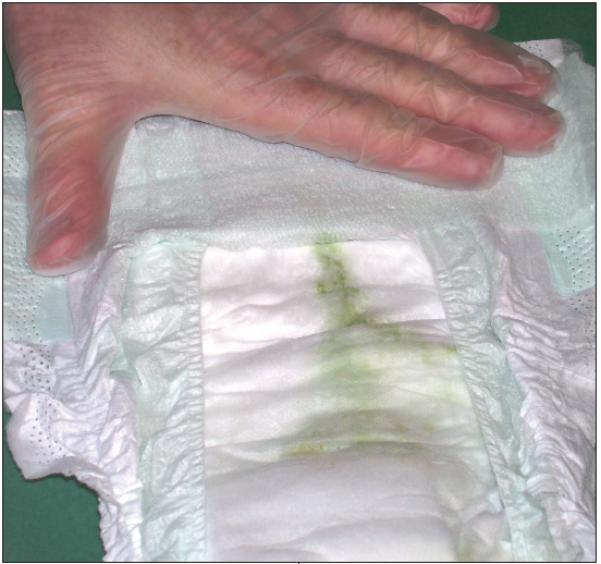 GreenColored Stool Consultant360